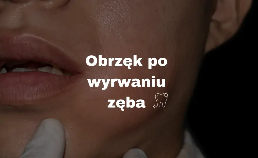Szybkie gojenie po ekstrakcji zęba: uniknij bólu i powikłań!