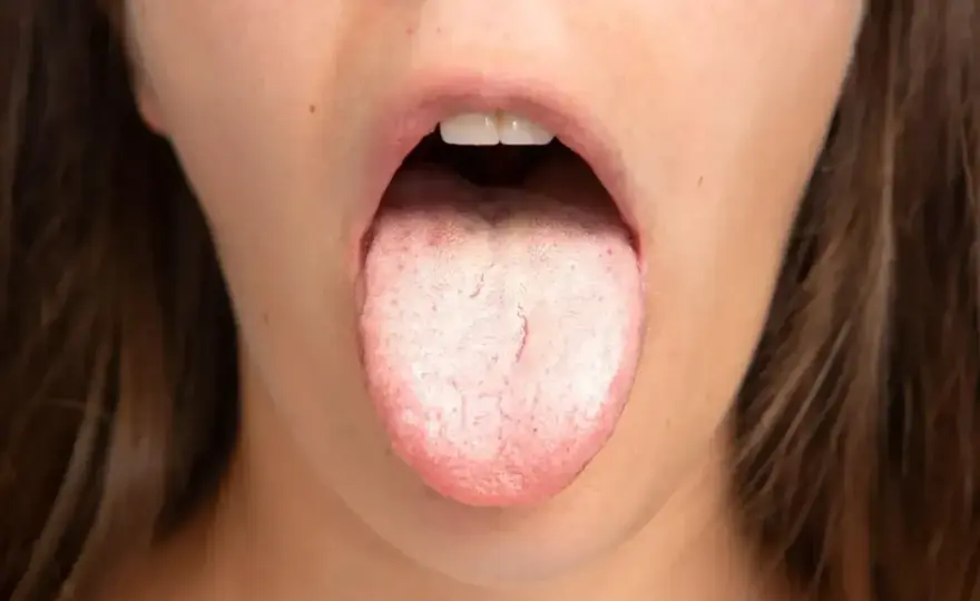 Objawy H. pylori w jamie ustnej - Czy to na pewno ona?