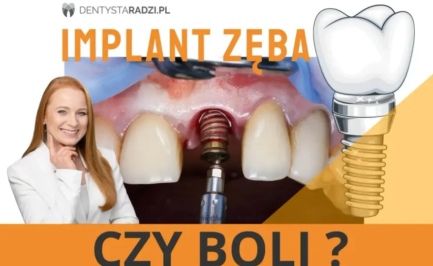 Czy implant zęba boli? Prawda o bólu i znieczuleniu