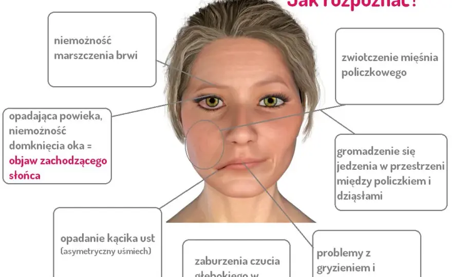 Ból twarzy i dziąseł po przewianiu? Poznaj objawy i skuteczne leczenie