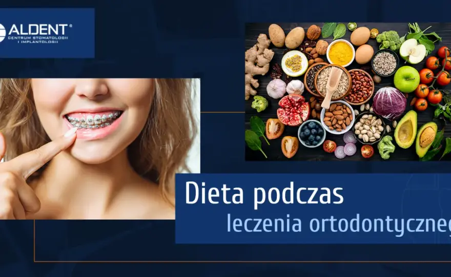 Dieta z aparatem ortodontycznym: Co jeść, by uniknąć bólu i awarii?
