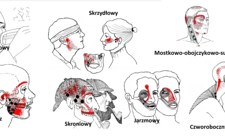 Ból przed uchem - Czy to nowotwór stawu skroniowo-żuchwowego?