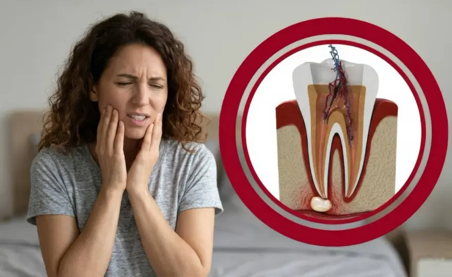 Ból zęba po latach od leczenia kanałowego - Diagnoza i leczenie