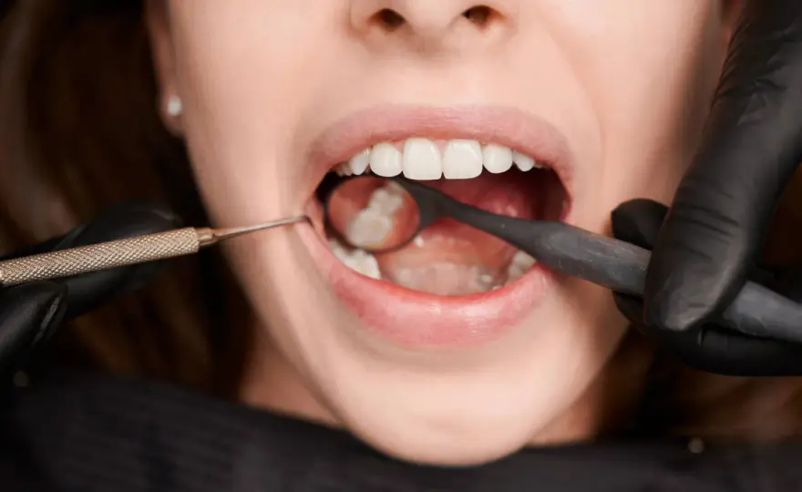 Ból zęba po leczeniu kanałowym przy nacisku - Kiedy do dentysty?