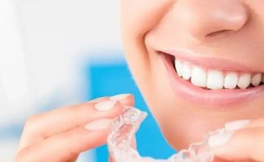 Invisalign - Wszystko, co musisz wiedzieć przed leczeniem