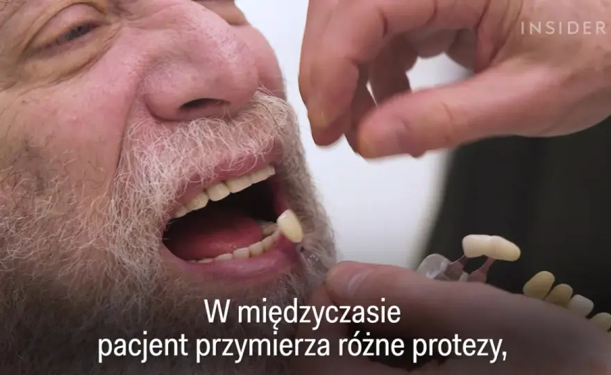 Czy dziąsła odrastają? Ekspert obala mity. Leczenie i profilaktyka
