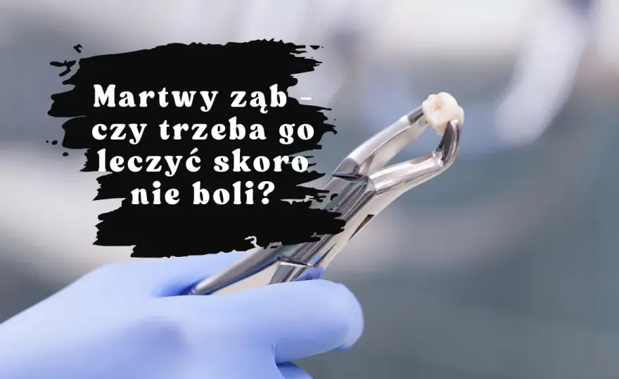 Nagły ból zęba w sobotę? Znajdź dentystę i ulgę krok po kroku