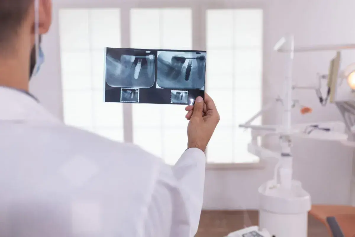 Dentysta analizuje RTG zęba, sprawdzając, ile kanałów ma 5.