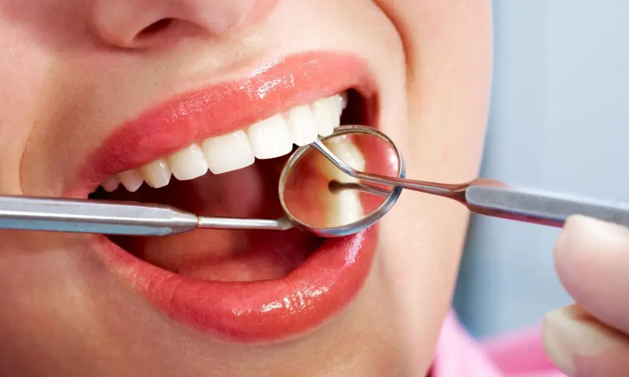 Uśmiech z błyszczącymi ustami i białymi zębami, badany lusterkiem dentystycznym. Czy bonding jest odwracalny?