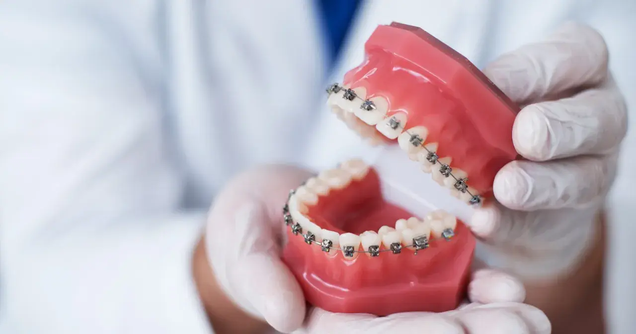 Dłonie w rękawiczkach trzymają model szczęki z aparatem ortodontycznym. To praca technika dentystycznego.