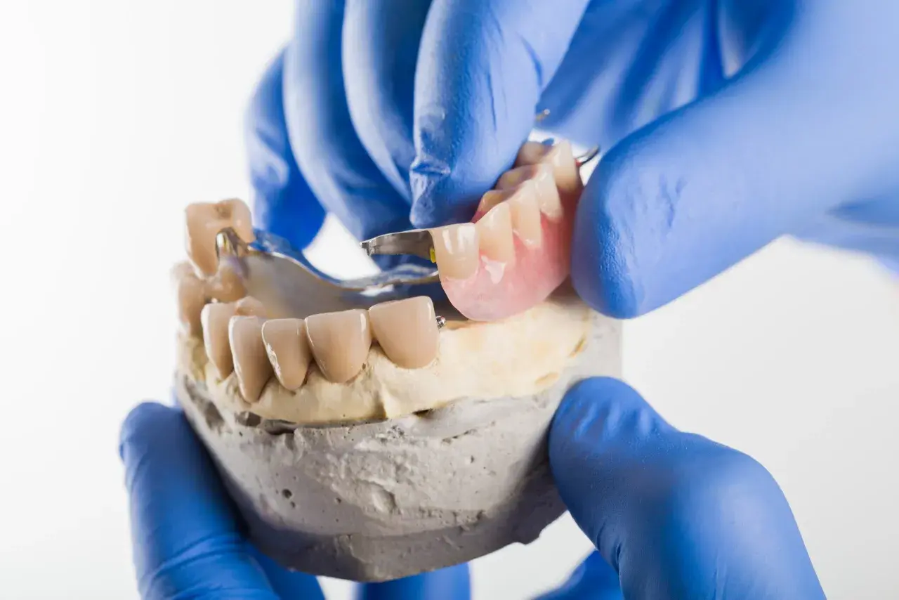 Dentyści prezentują protezę szkieletową na zatrzaskach, dopasowując ją do modelu szczęki.