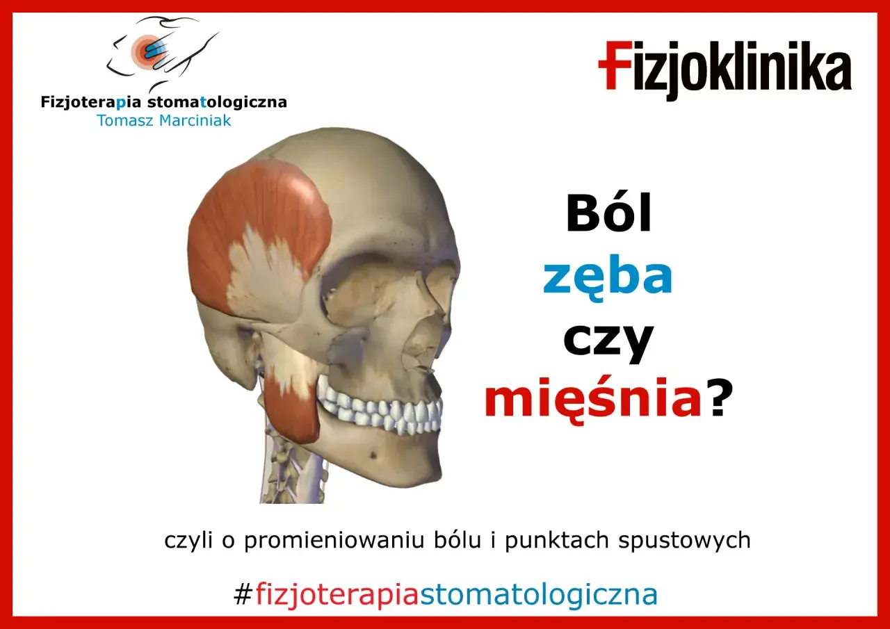 Model czaszki z zaznaczonym mięśniem skroniowym, ilustrujący ból szczęki w zawiasach. Czy to ból zęba czy mięśnia?