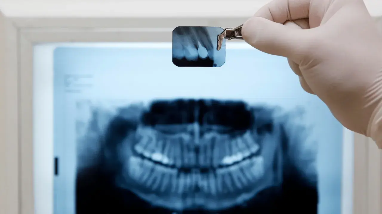 Rtg zęba jak odczytać? Dentysta trzyma małe zdjęcie RTG, analizując je na tle większego obrazu szczęki.