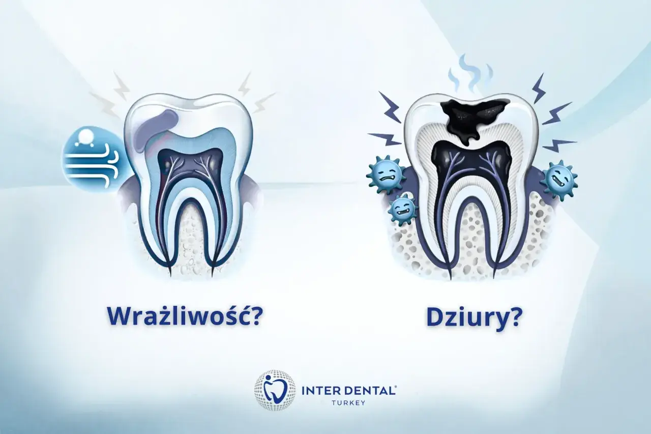 Wrażliwy ząb reaguje na zimno, a próchnica powoduje ból zęba przy nagryzaniu.