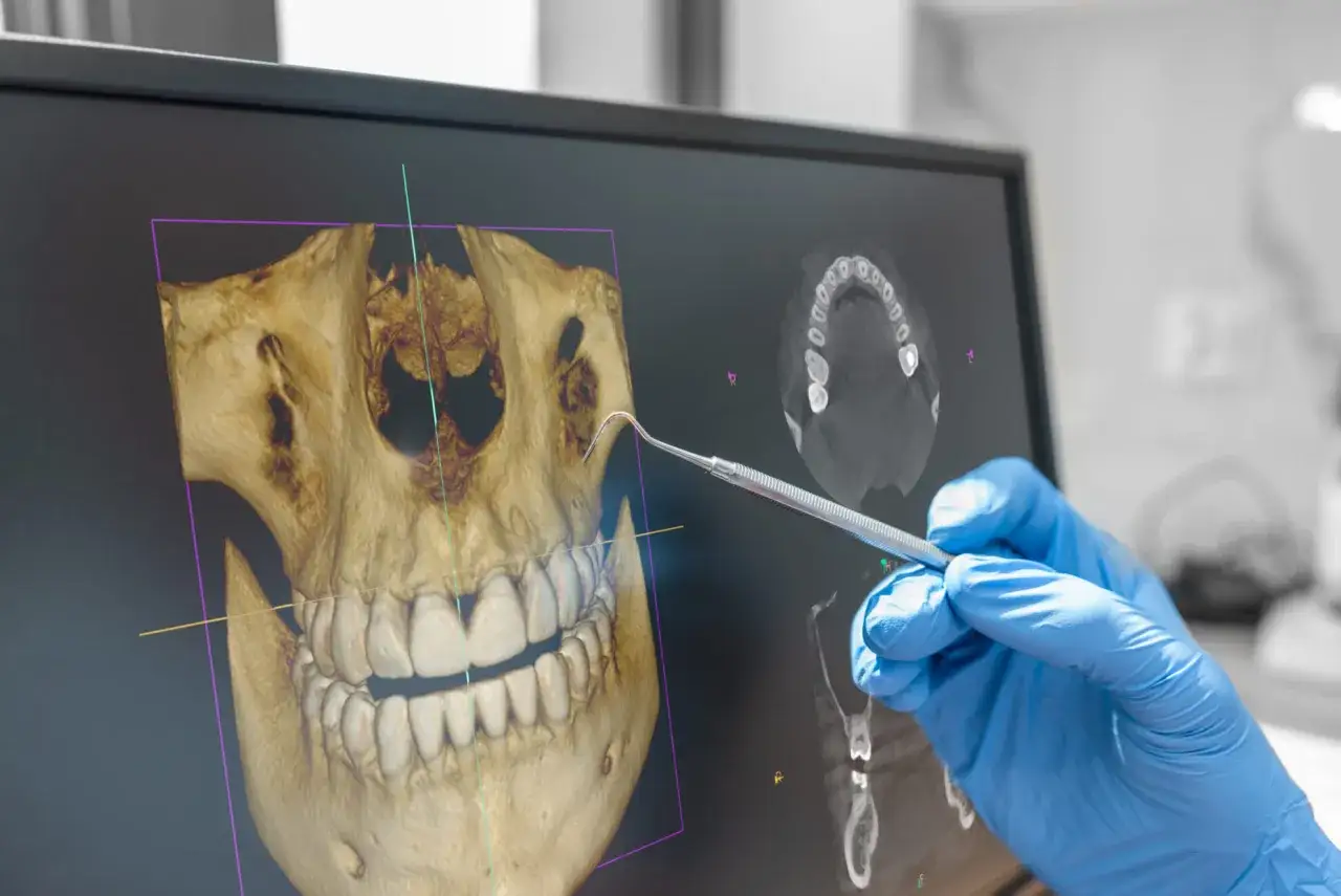 Dentysta analizuje obraz CBCT szczęki, wskazując narzędziem na szczegóły 3D.