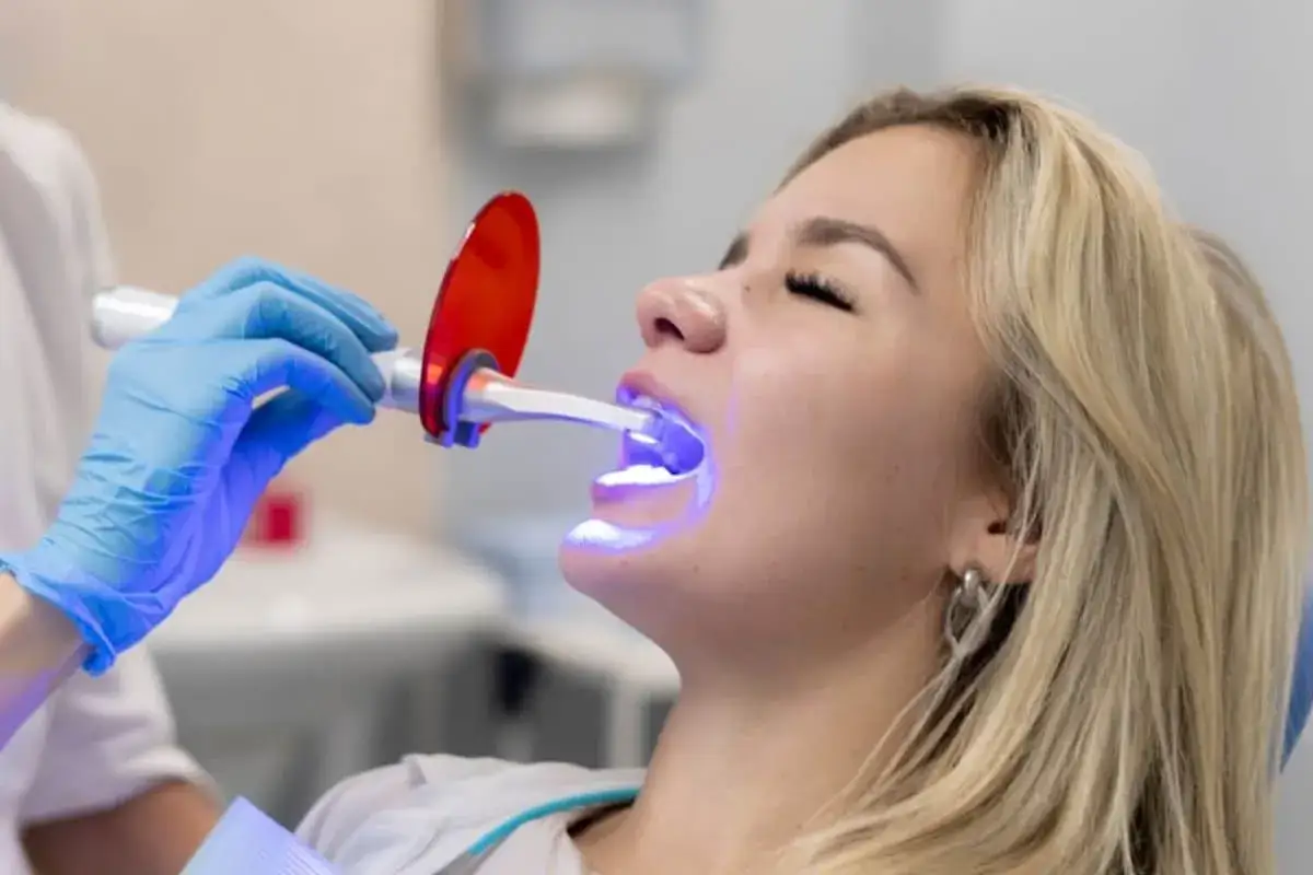 Zabieg wybielania zębów z użyciem lampy LED. Dentysta w rękawiczce przykłada urządzenie do ust pacjentki, aby uzyskać olśniewający uśmiech.