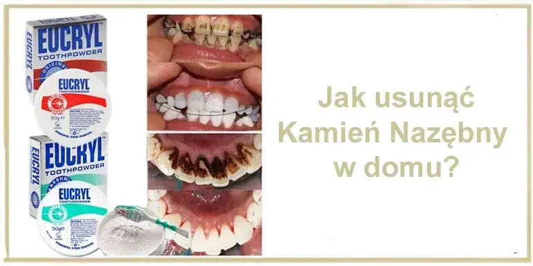 Domowe sposoby usuwanie kamienia nazębnego mity szkliwo