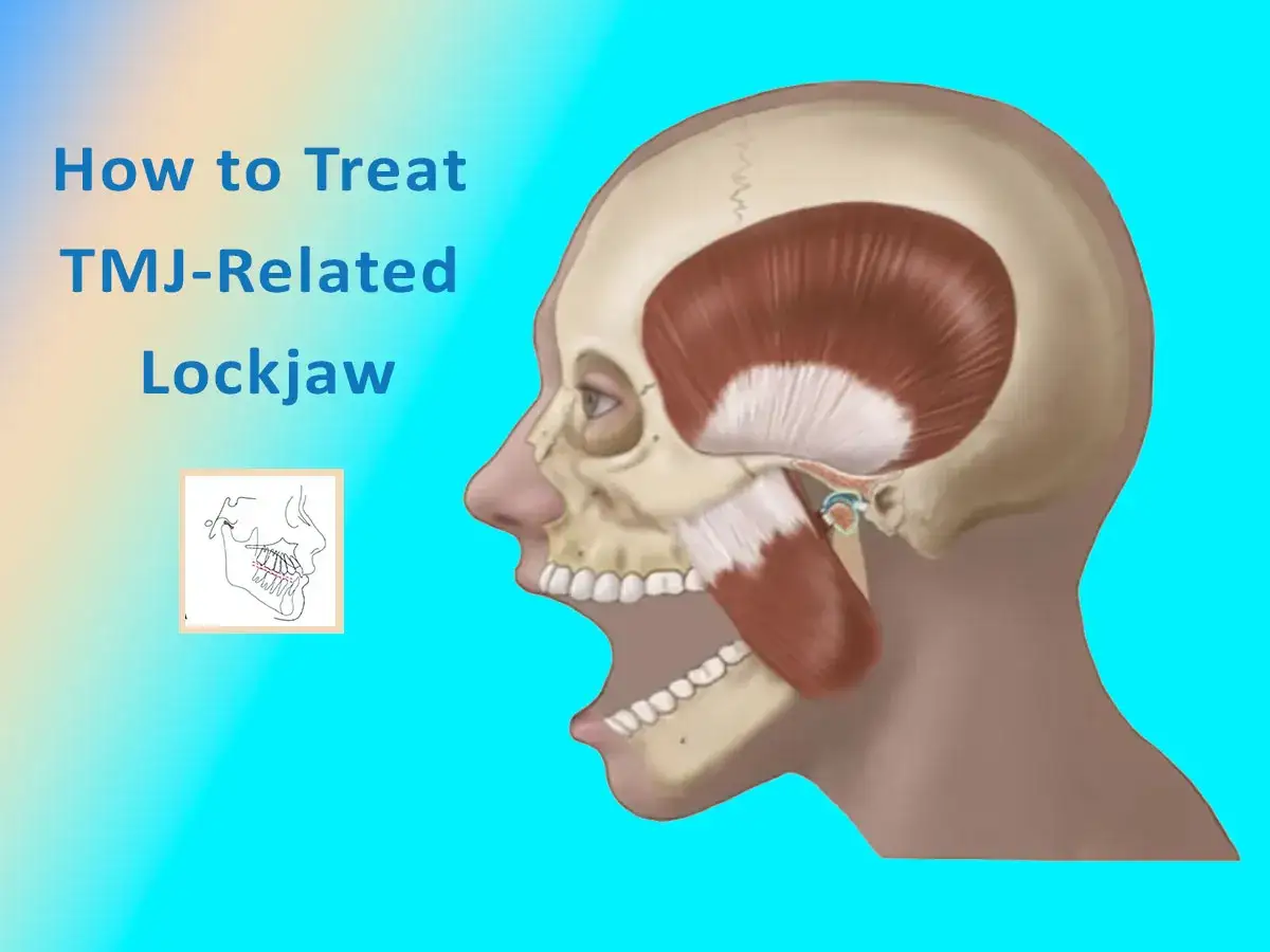Anatomia stawu skroniowo żuchwowego, pokazująca mięśnie i kości. Tekst: 