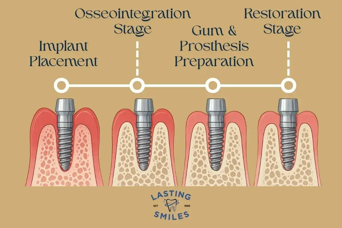 Schemat przedstawia etapy leczenia implantologicznego: od wszczepienia implantu, przez osteointegrację, przygotowanie dziąseł i protezy, aż po etap odbudowy. Widoczna śruba gojąca implant jest kluczowa.