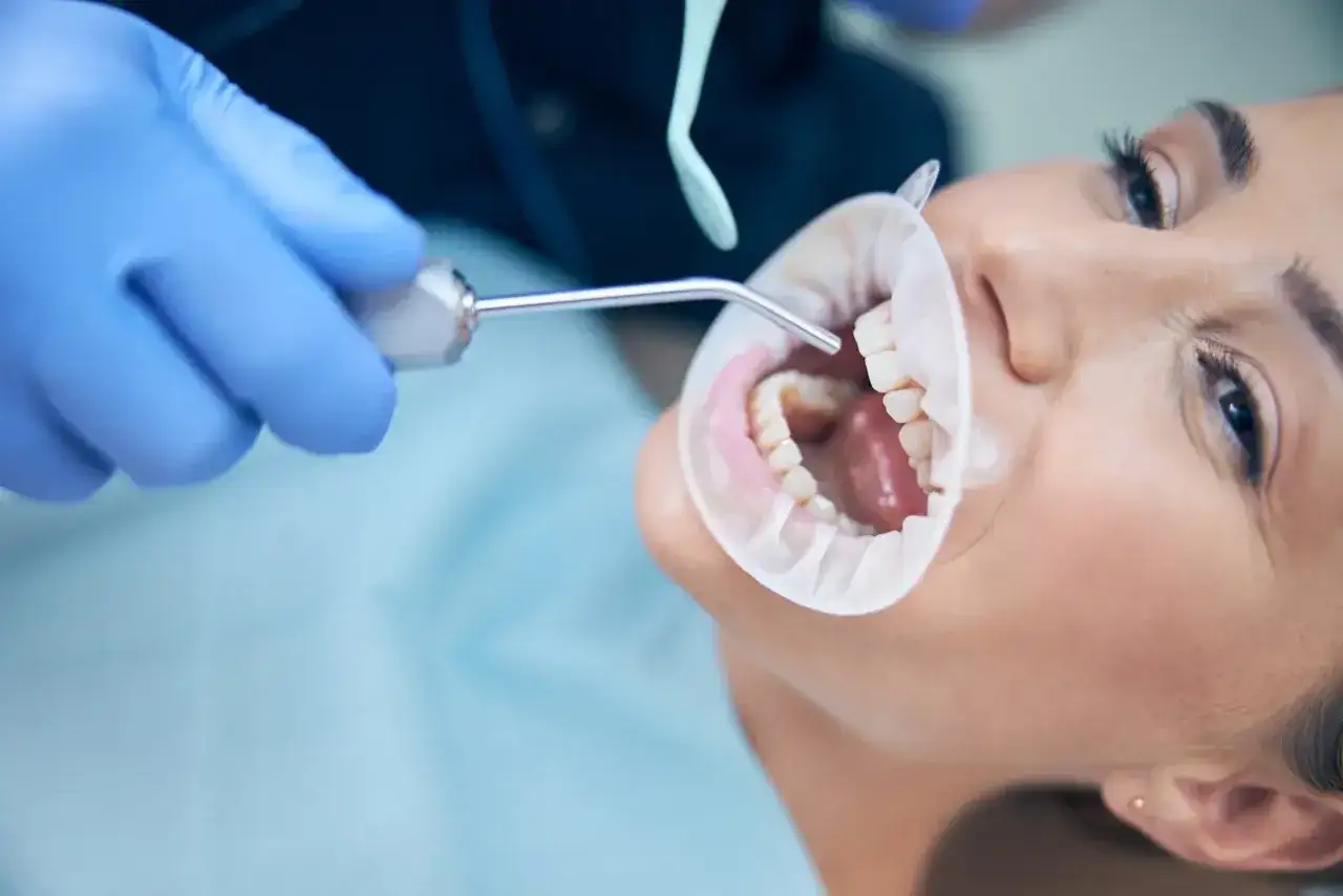 Dentysta usuwa próchnicę między zębami u pacjentki.