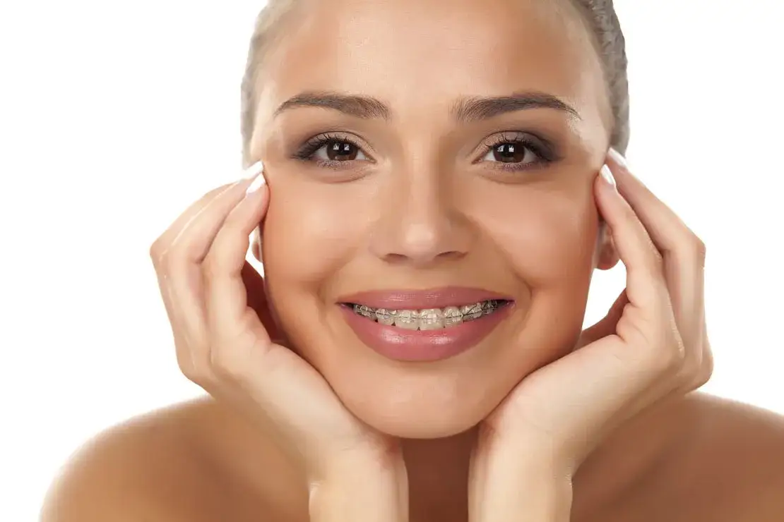 Aparat ortodontyczny na zębach z ustami