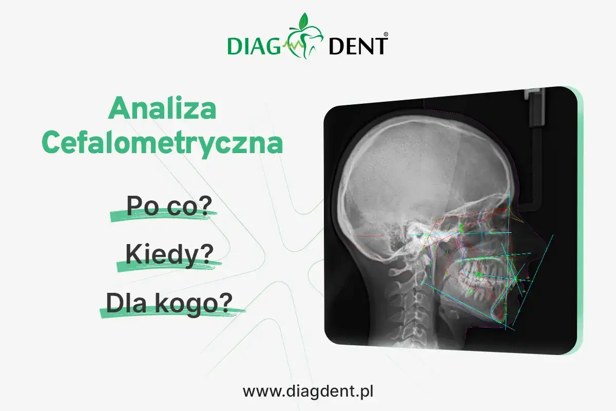 Analiza cefalometryczna: zdjęcie czaszki z naniesionymi liniami i punktami pomiarowymi. Informacje o badaniu: Po co? Kiedy? Dla kogo?