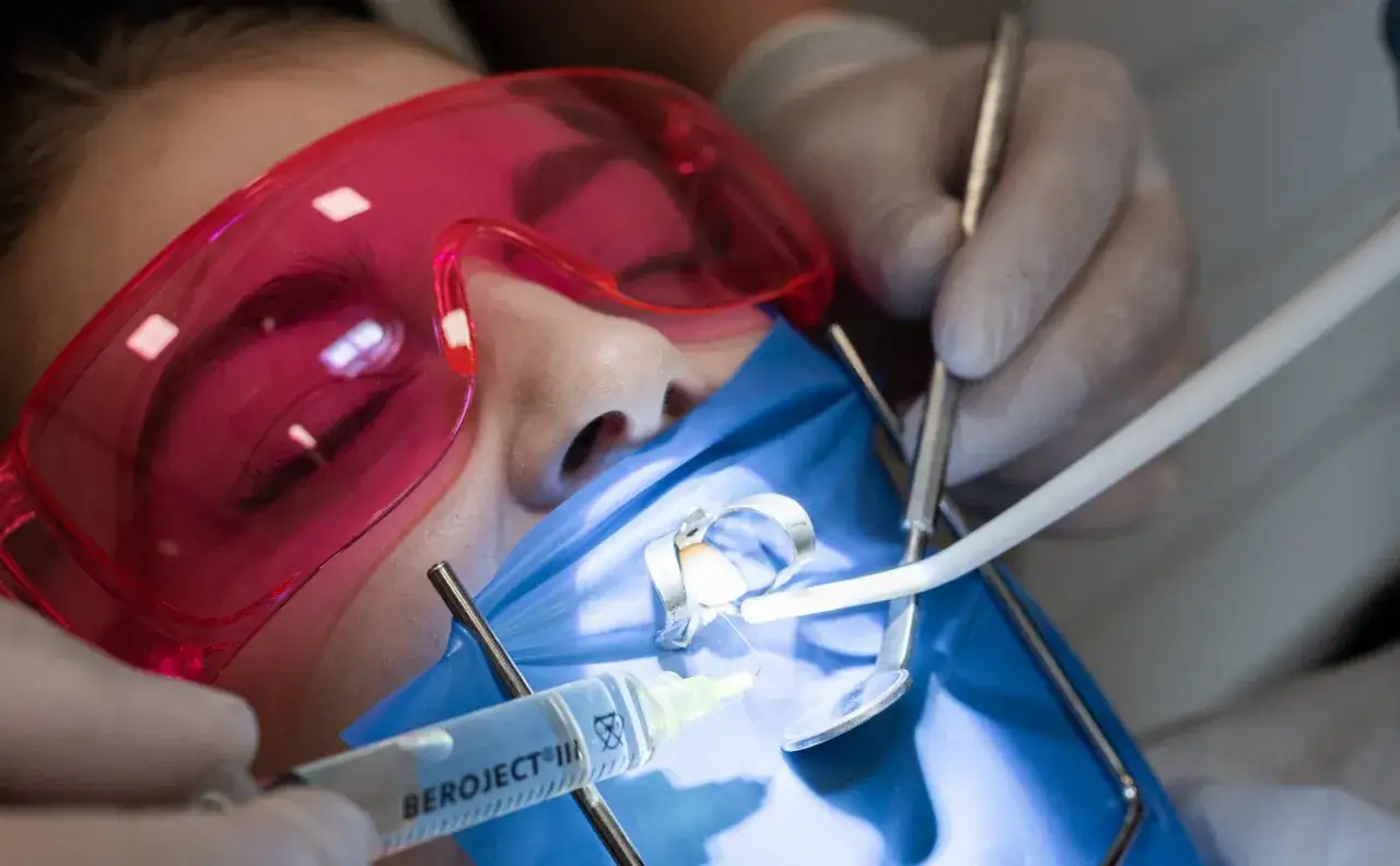 Zabieg stomatologiczny, podczas którego dentysta pracuje przy zębie pacjenta, używając narzędzi i strzykawki. Widoczna jest miazga zęba.