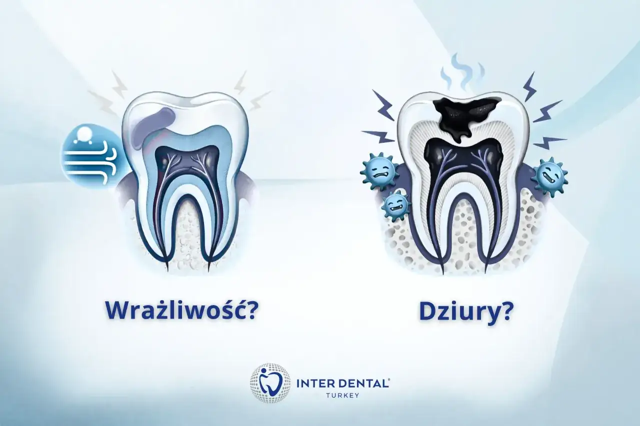 Wrażliwy ząb przy nagryzaniu? Zobacz, jak próchnica niszczy zęby.