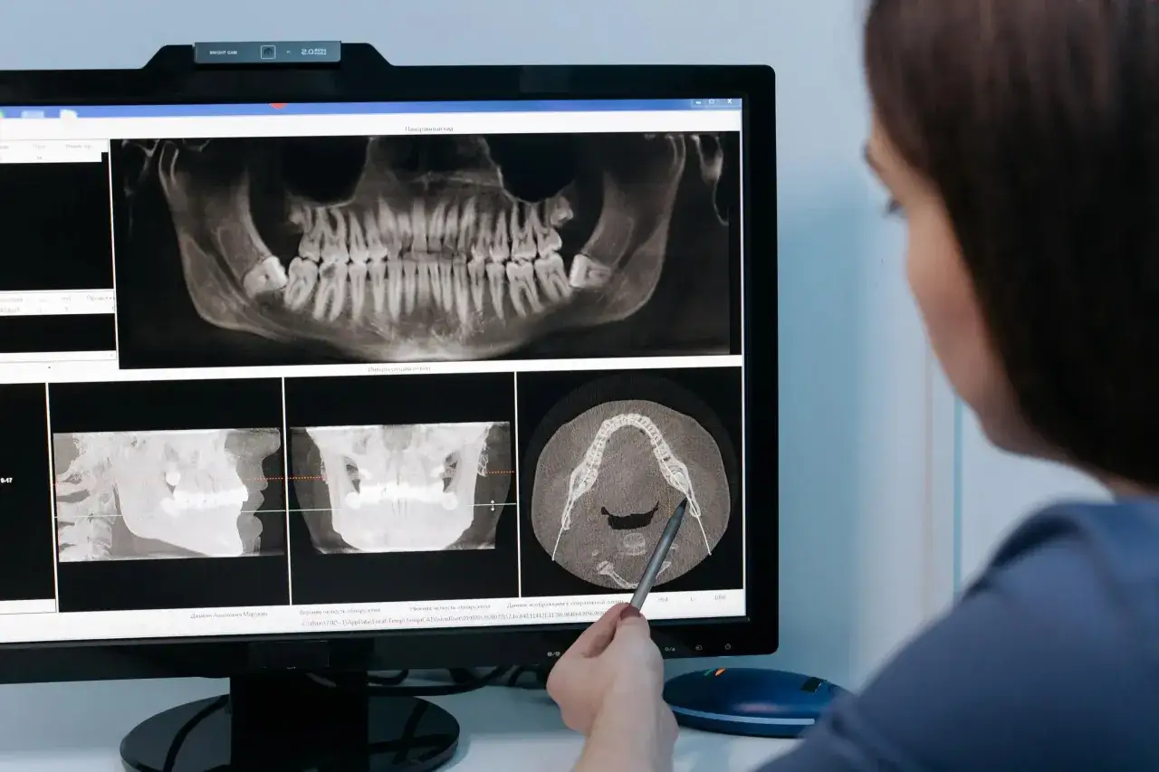 Dentysta analizuje pantogram i przekroje szczęki na monitorze, badając szczegóły uzębienia.