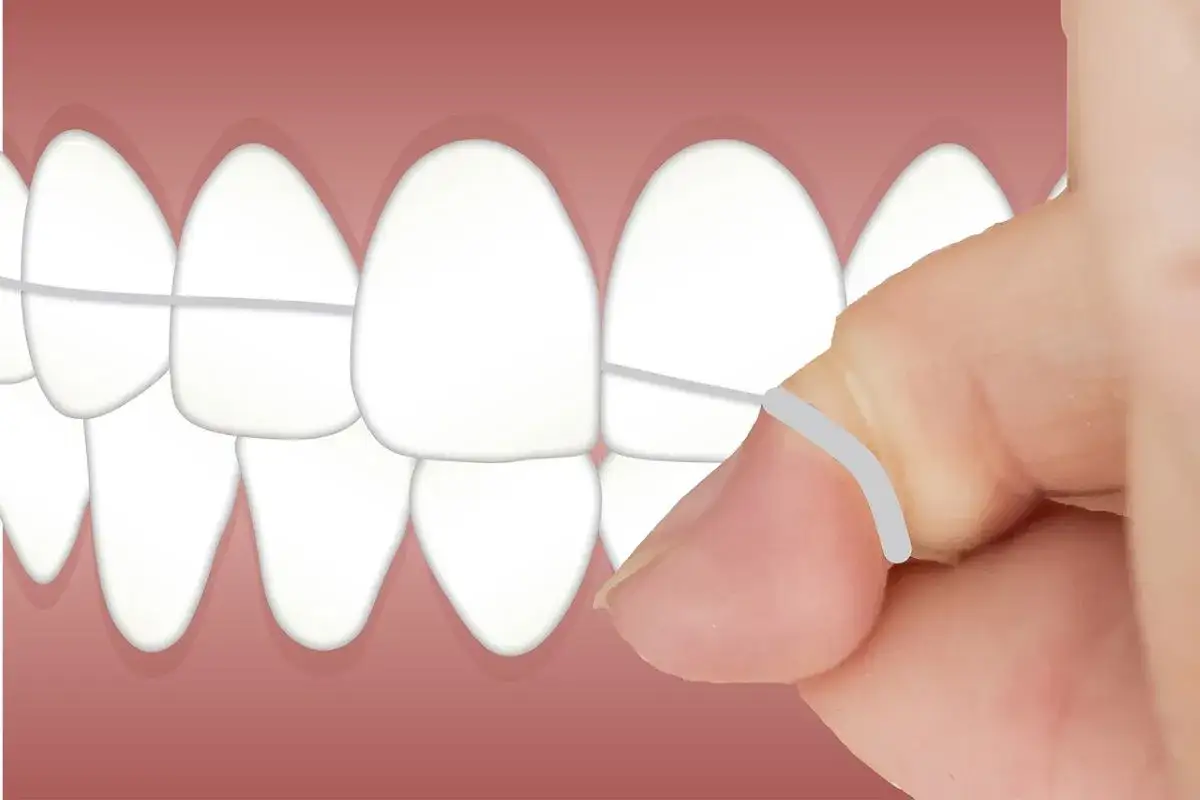 Dłoń z nicią dentystyczną między zębami, ilustrująca prawidłowe mycie zębów.