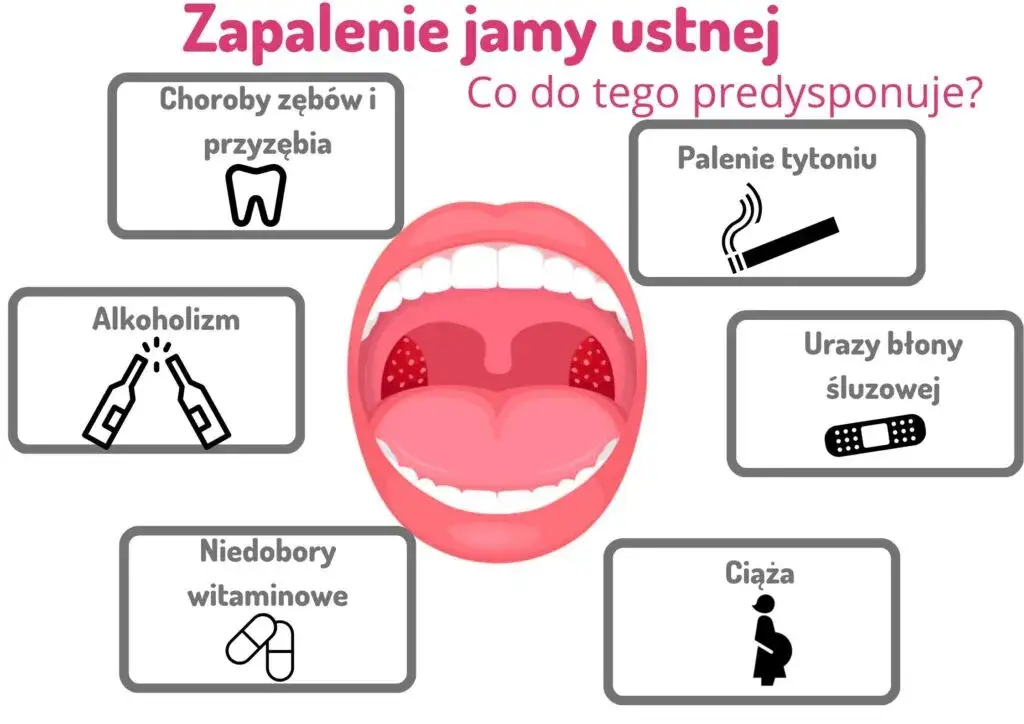 różne rodzaje zapalenia jamy ustnej